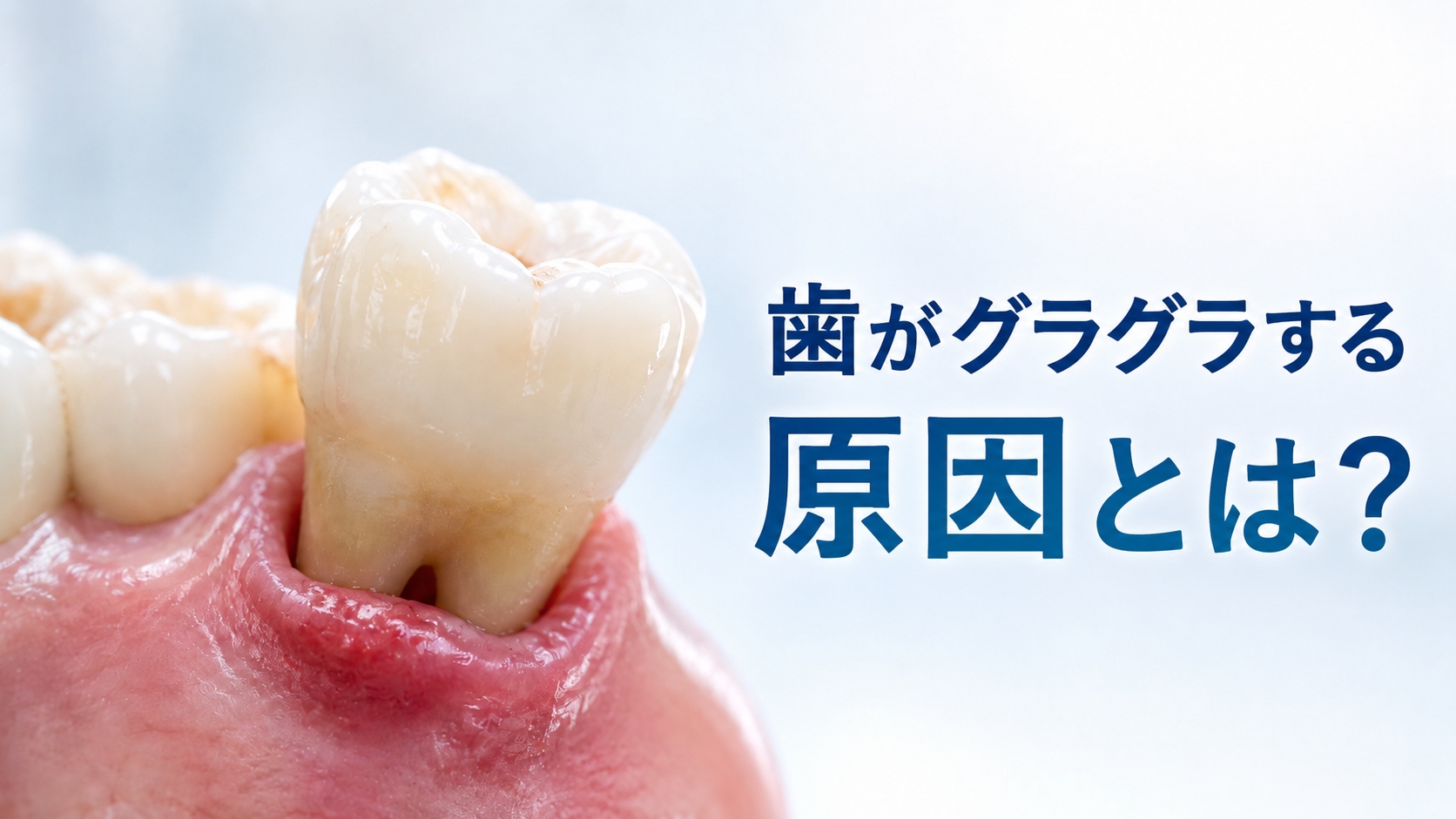 歯がグラグラする原因とは？抜歯が必要なケースと残せるケース